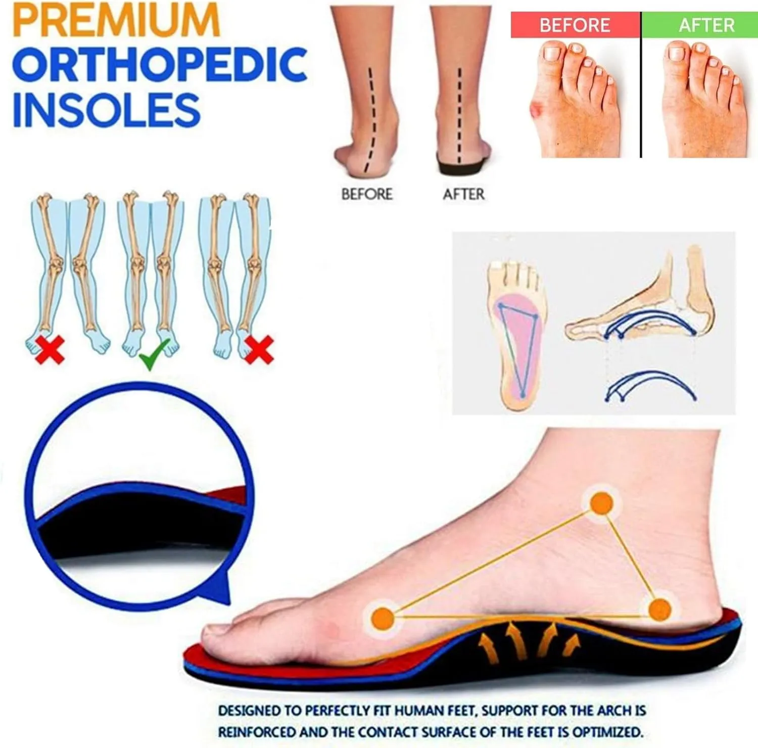 Mules for Women Casual Orthopedic Diabetic Walking Shoes with Arch Support Breathable Hollow Out Closed Toe Sandals Slip On Slippers Summer Backless Sandals Comfort Outdoor Beach Slippers